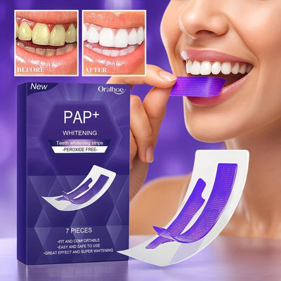 At-Home Whitening Treatment